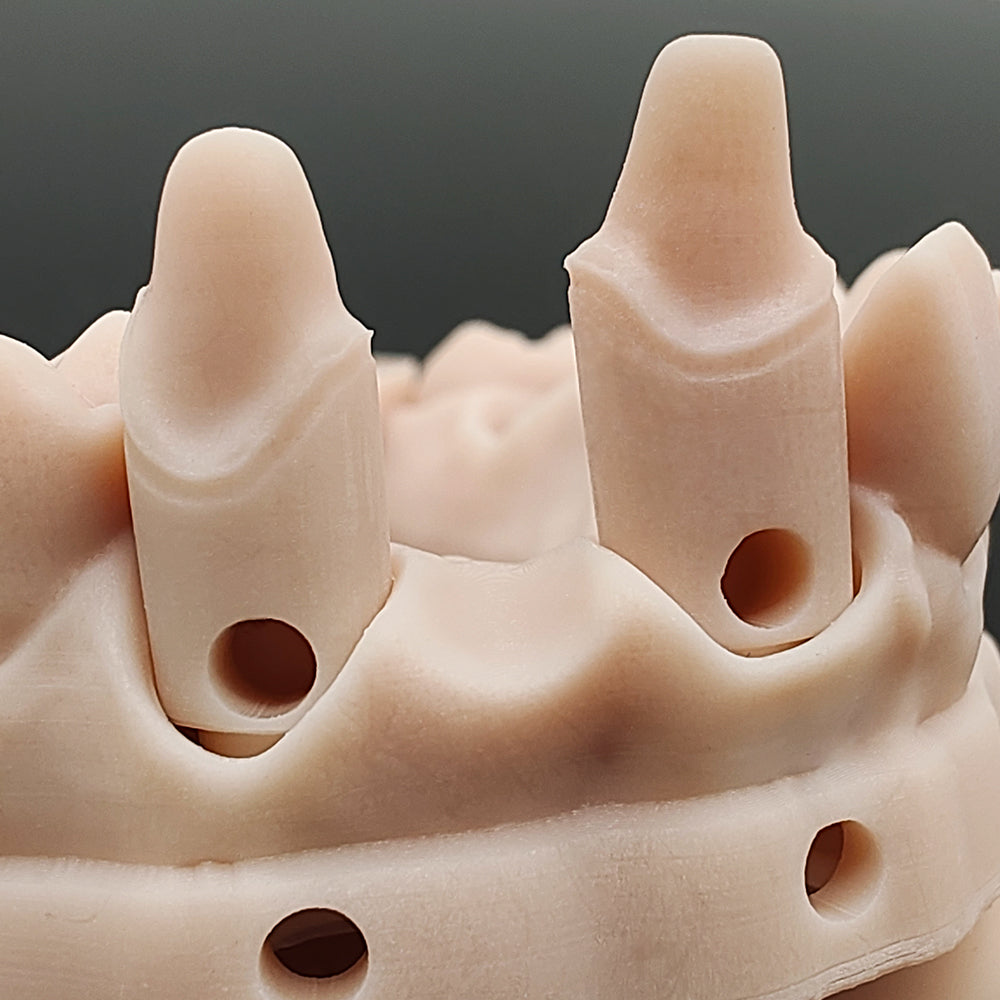 VASDEN 3D Printing Dental Professional Model Resin Liquid